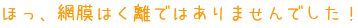 ほっ、網膜はく離ではありませんでした！